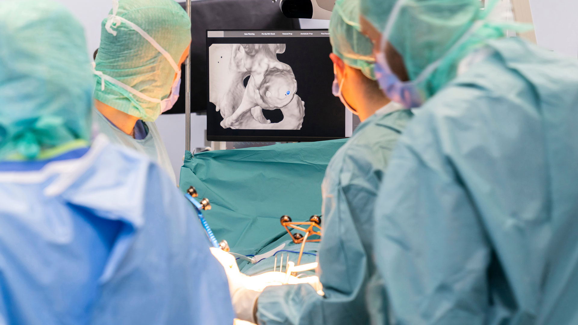 Alleged Improper Performance of Hip Surgery